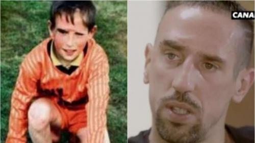 Ribery habl&oacute; de su dura infancia y de la cicatriz que marc&oacute; su vida