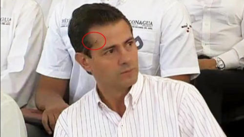 Pe&ntilde;a Nieto apareci&oacute; en p&uacute;blico con una herida en la cabeza