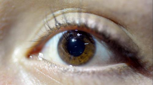 Esta es la raz&oacute;n por la que sigues viendo cuando parpadeas