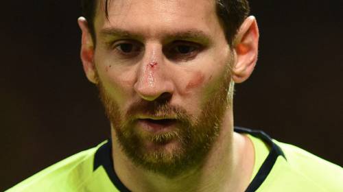 Así fue la jugada en la que casi le quiebran la nariz a Messi