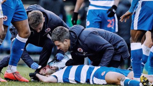 Le desfiguran el rostro a futbolista con un impresionante pisotón