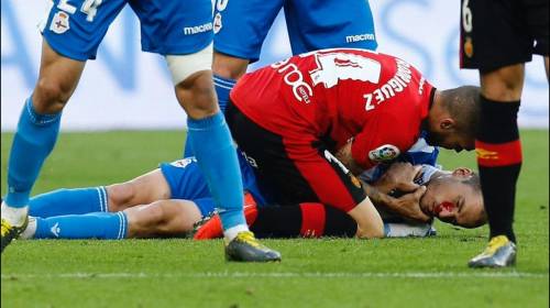 Al quirófano y 70 puntos de sutura por brutal patada en la boca