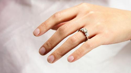 Perder el dedo &oacute; perder un anillo, el dilema que se volvi&oacute; viral