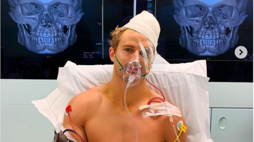 El brutal nocaut que casi le cuesta la vida a un peleador de MMA