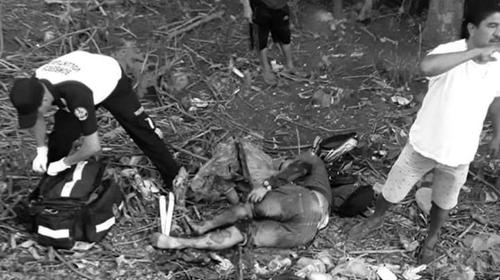 Exfutbolista sufre terrible accidente y podría perder la pierna