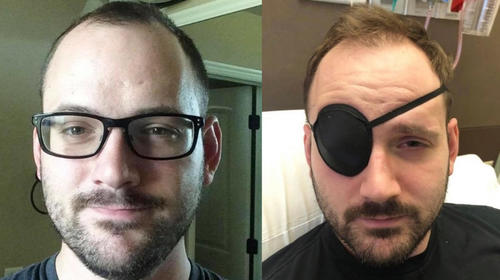 Hombre sufre derrame cerebral por &ldquo;tronarse&rdquo; el cuello