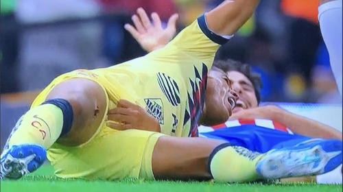 Así reconstruyeron el muslo de Gio dos Santos tras su dura lesión