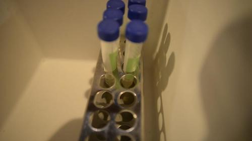 Salud esperaba un mayor número de casos de Covid-19 esta semana