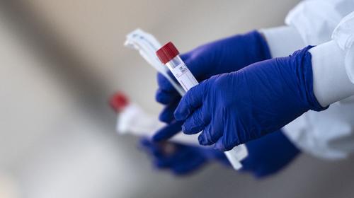 Hospitales privados harán pruebas de coronavirus 