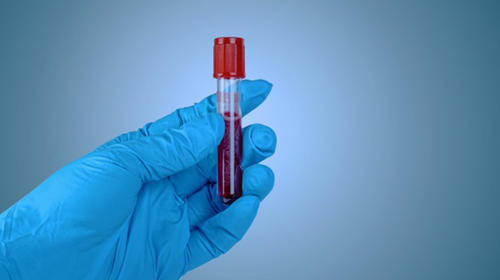 Plasma de recuperados de Covid-19 reduce muertes en más del 50%