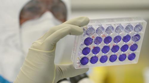 Covid-19: Rusia promete millones de vacunas a finales de 2020