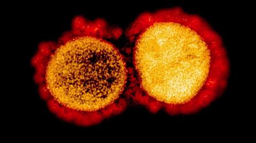 Científicos descubren una forma para debilitar el coronavirus 