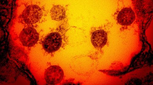 EE.UU. desarrolla cepa de coronavirus para pruebas con humanos