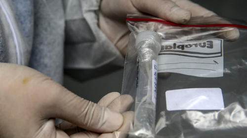 ¿Por qué las pruebas de Covid-19 bajan los fines de semana?