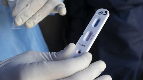 Salud advierte por pruebas de sangre no autorizadas para Covid-19