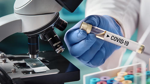 COVID-19: &iquest;Qu&eacute; se sabe de la nueva cepa del virus?