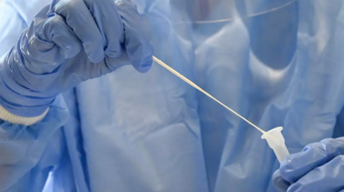 Covid-19: ¿Guatemala tiene capacidad para detectar la nueva cepa?