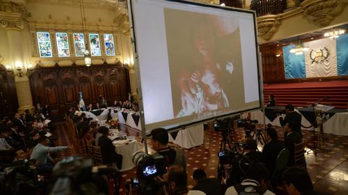 El ni&ntilde;o con el que Giammattei ejemplific&oacute; la desnutrici&oacute;n