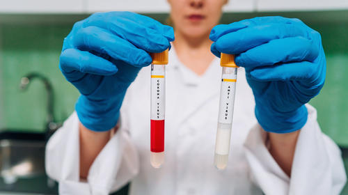 Resultados de ensayos clínicos contra Covid no son satisfactorios