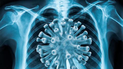 Estas son las secuelas que puede dejar el Covid-19, según médicos