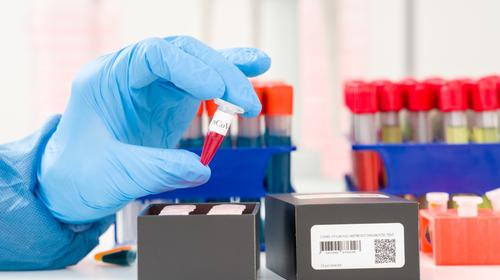 El "covídmetro", una máquina para la detección rápida del virus