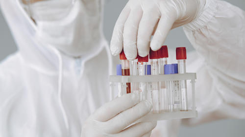 Costa Rica avanza con prueba preclínica para combatir el Covid-19