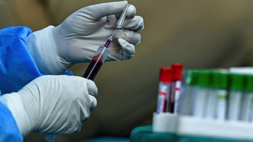 Así se extrae el plasma que se dona a pacientes con Covid-19