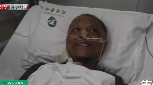 Muere médico chino que cambió de color de piel por coronavirus