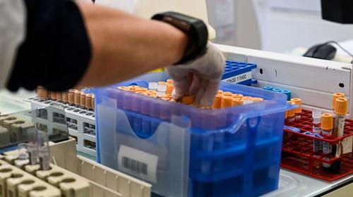 Confirman 641 nuevos casos de Covid-19, cifra sube a 12,509