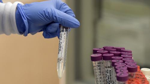 Diputada revela que Salud no ha procesado 4,909 test de Covid-19