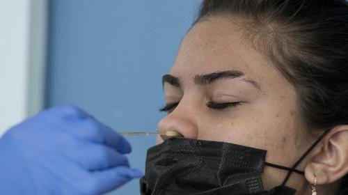 Reportan 479 casos de Covid-19 este lunes