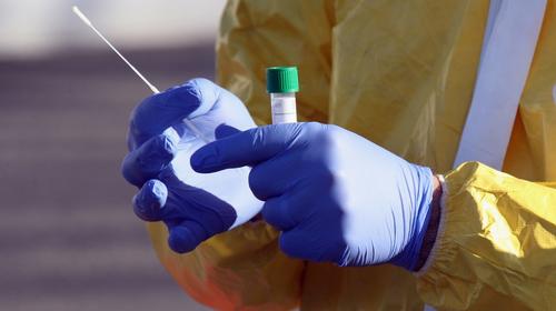 Usan medicina contra la malaria para tratar el Covid-19