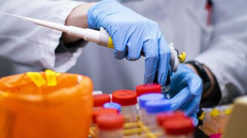 ¿Qué se sabe de la cloroquina para combatir el nuevo coronavirus?