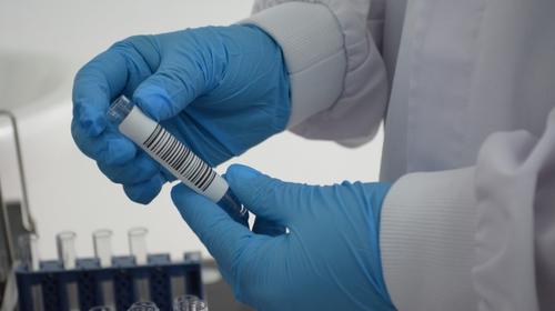 ¿Cómo terminaron las pandemias que han afectado a la humanidad?