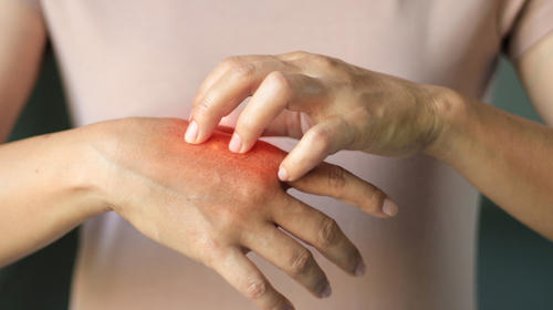 México reporta 89 casos de lepra en 2020 