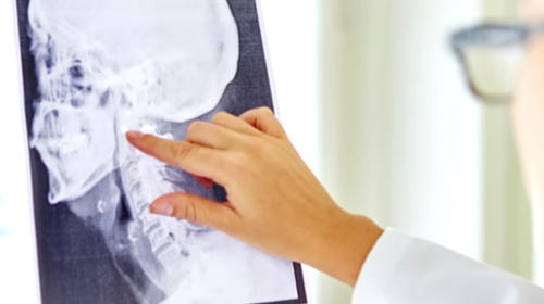 Descubren un posible nuevo órgano en la garganta humana