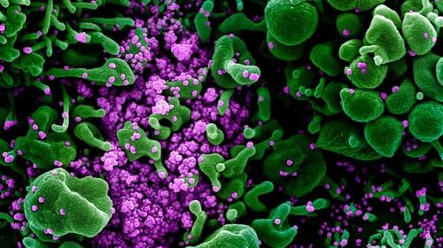 Computadora explica por qué el Covid-19 afecta los órganos