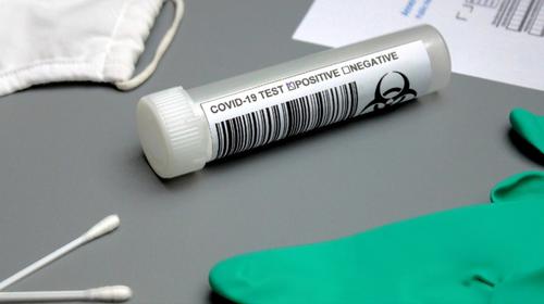 Crean prueba para detectar al coronavirus en 20 segundos