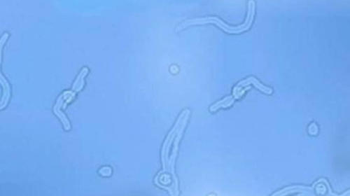 Cuerpos o manchas flotantes en el ojo ¿por qué los ves?