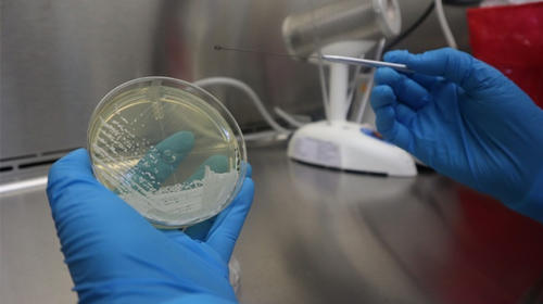 Alerta por Candida Auris: un peligroso hongo detectado en el país