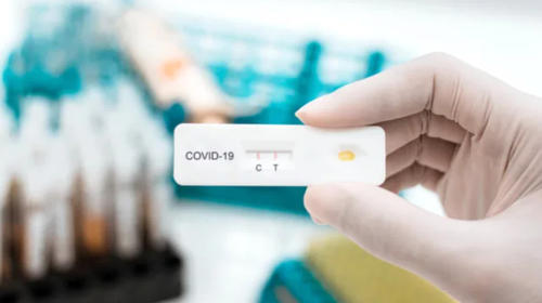 Descubren nueva y peligrosa variante de covid-19 en Nueva York 