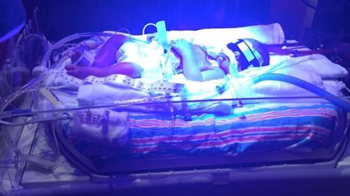 La foto viral de unos gemelos que conmovi&oacute; en las redes sociales 