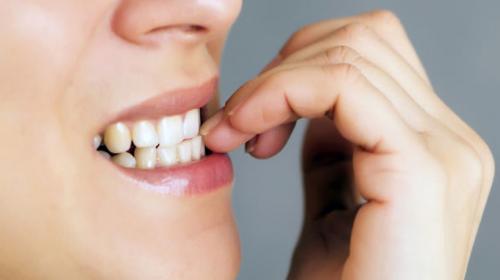 &iexcl;Atenci&oacute;n! Si te comes las u&ntilde;as podr&iacute;as sufrir de estas afecciones